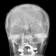Imagen para el artículo titulado Descubren un nuevo método para detectar Parkinson en tres minutos